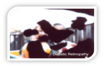 The view is very blurry due to Diabetic Retinopathy
